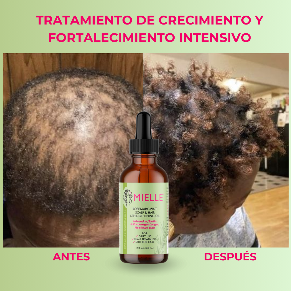 MIELLE SERUM UND ADICIONAL at